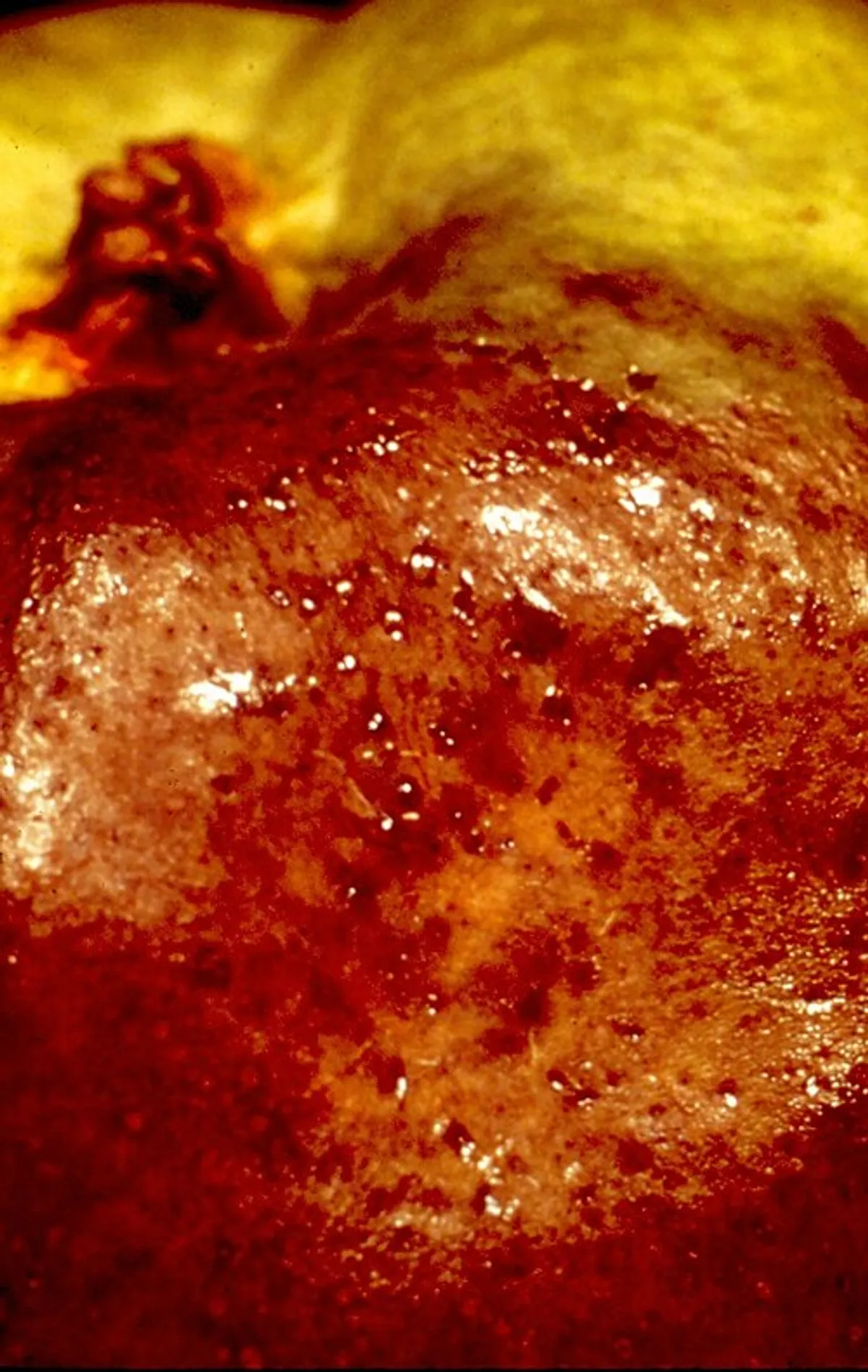 Fire Blight vs. Pseudomonas: Diagnosing Spring Shoot Blight